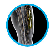 columnadreta_physium4